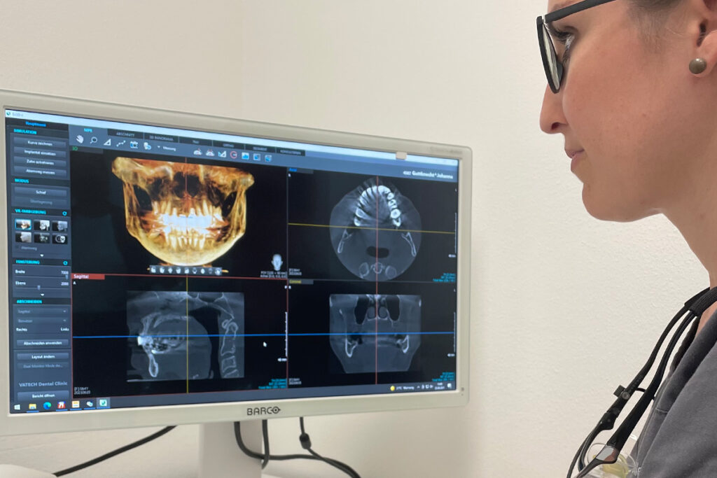 Foto zeigt 3D Röntgenbilder für die Planung einer Implantation