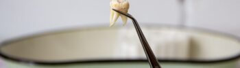 Ein ausgefallener Zahn vor einer Schale, festgehalten durch eine Zange.